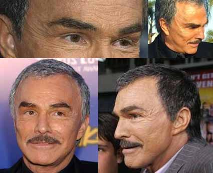 Celebrity Burtreynolds Plastic Surgery Before And After 