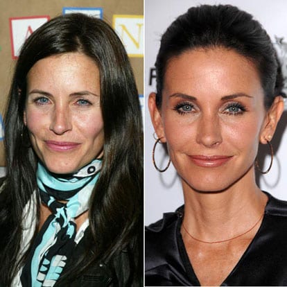 Celebrity Courtney Cox Plastic Surgery Before And After 