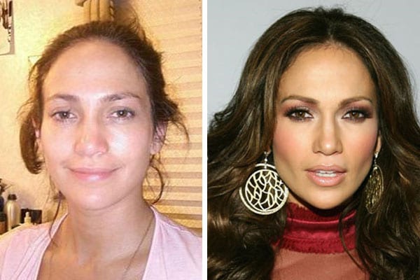 Celebrity Jenniferlopez Plastic Surgery Before And After 
