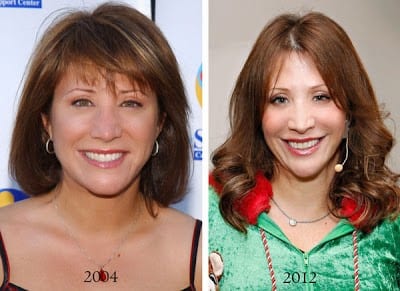 Cheri Oteri Plastic Surgery Before And After 