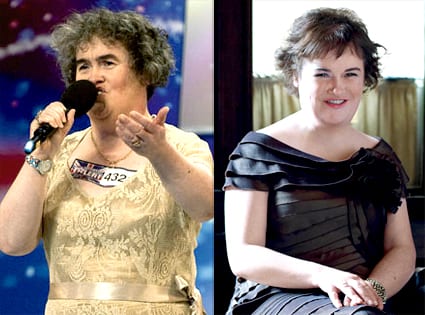 Susan Boyle Plastic Surgery 