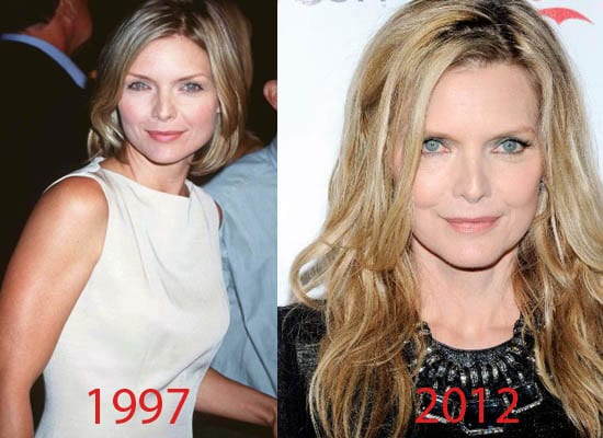 Michelle Pfeiffer Plastic Surgery Before and After 